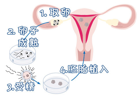 光愈生殖医学中心环境